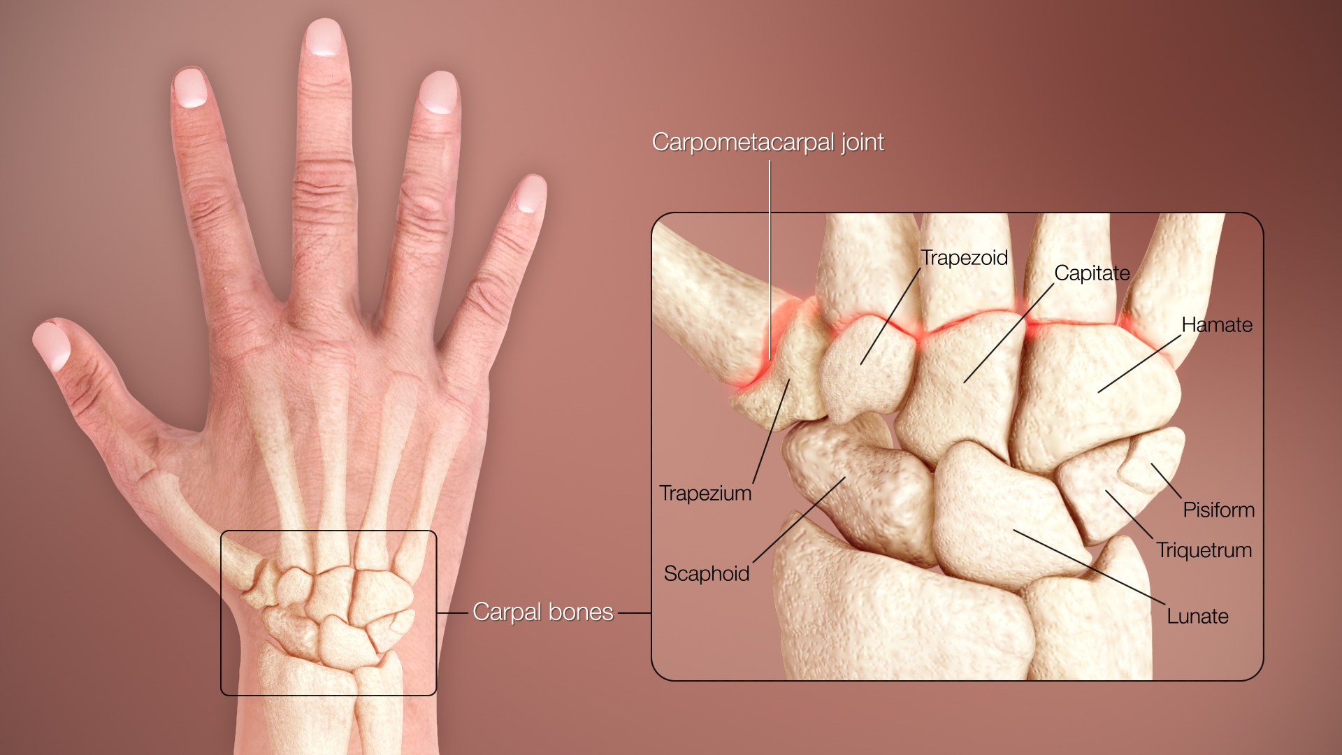 Carpal Bones Wikipedia
