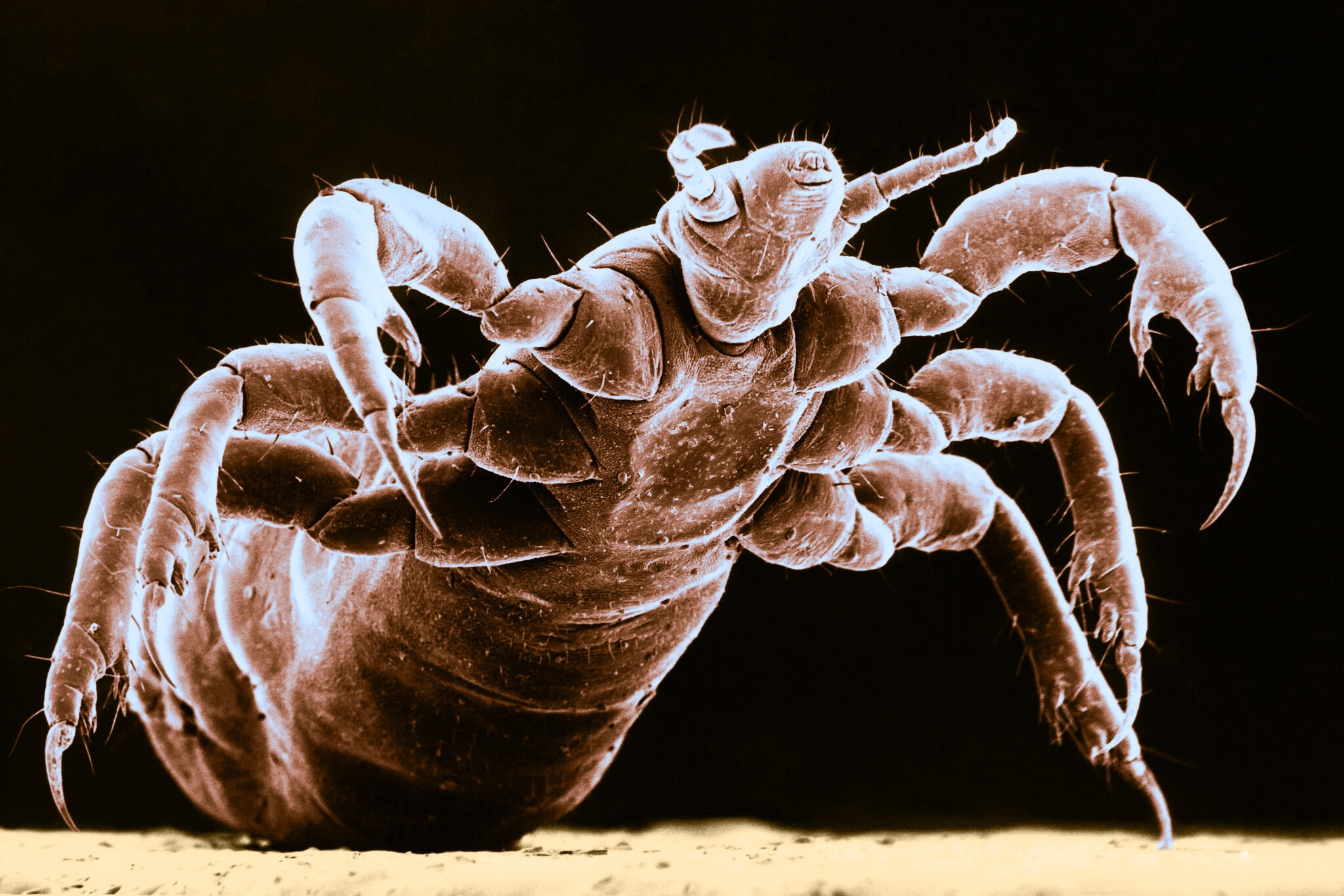 Ever Feel Your Skin Crawling Maybe You Can Thank Evolution The New York Times